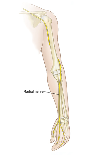 Front view of arm showing bones and radial nerve.