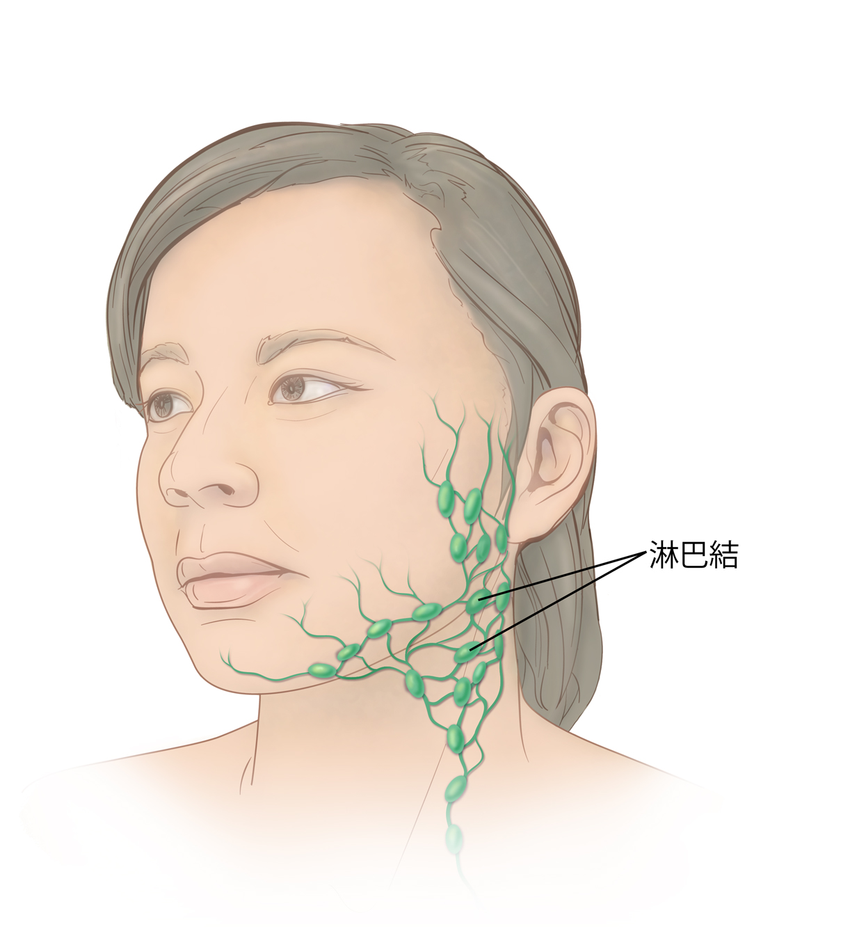 女人的頭和脖子，顯示了淋巴結