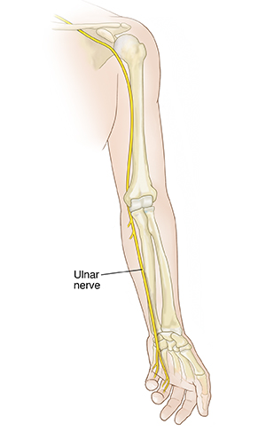 Front view of arm with palm up showing bones and ulnar nerve.