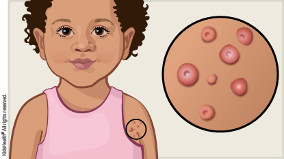 KidsHealth Image