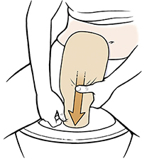 Woman sitting on toilet emptying ostomy pouch into toilet.