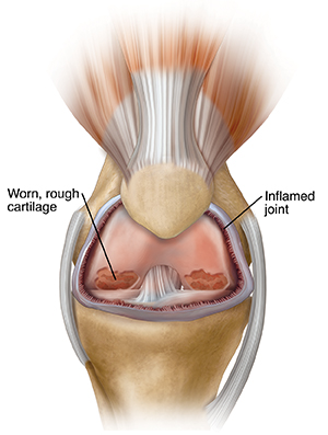 Front view of problem knee.