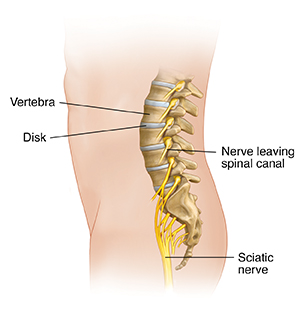 Side view of male figure showing lumbar spine anatomy and sciatic nerve.