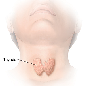 Mga Ilustrasyon ng Karaniwang mga Problema sa Thyroid (3) Medikal na ilustrasyon Harapa na larawan ng ulo at leeg na ipinapakita ang thyroid.